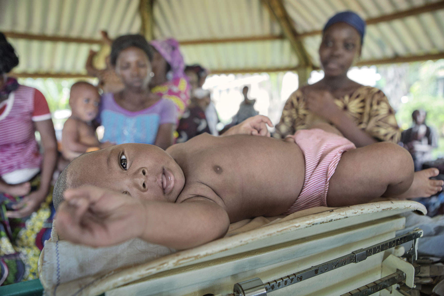 The skin of Africa - Project by Ana Palacios Visual Journalist