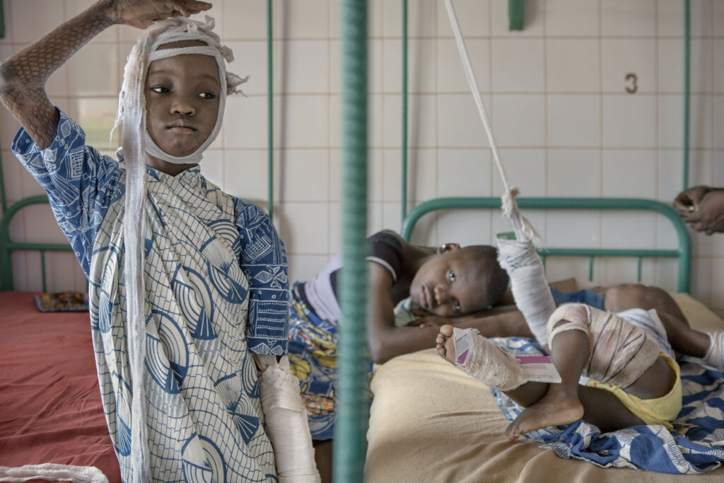 The skin of Africa - Project by Ana Palacios Visual Journalist