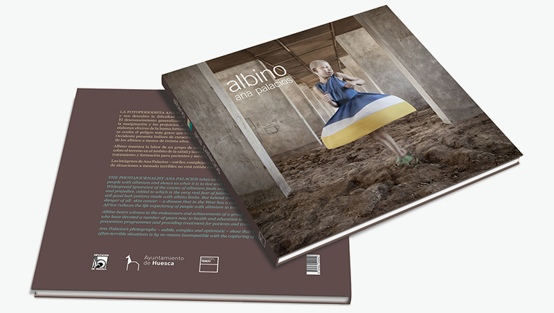 Albino - Book by Ana Palacios Visual Journalist