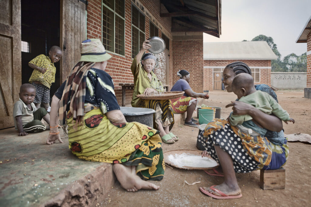 Albino - Project by Ana Palacios Visual Journalist