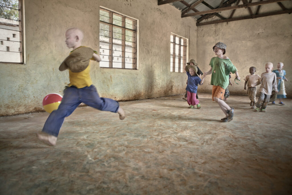 Albino - Project by Ana Palacios Visual Journalist