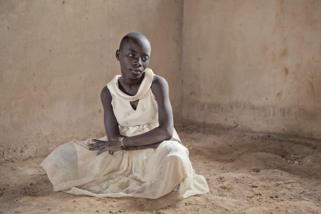 Albino - Project by Ana Palacios Visual Journalist