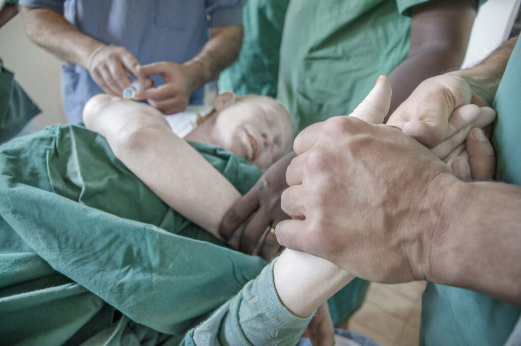 Albino - Project by Ana Palacios Visual Journalist