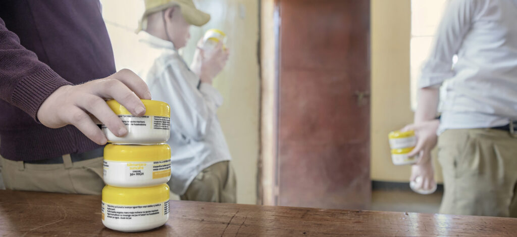 Albino - Project by Ana Palacios Visual Journalist