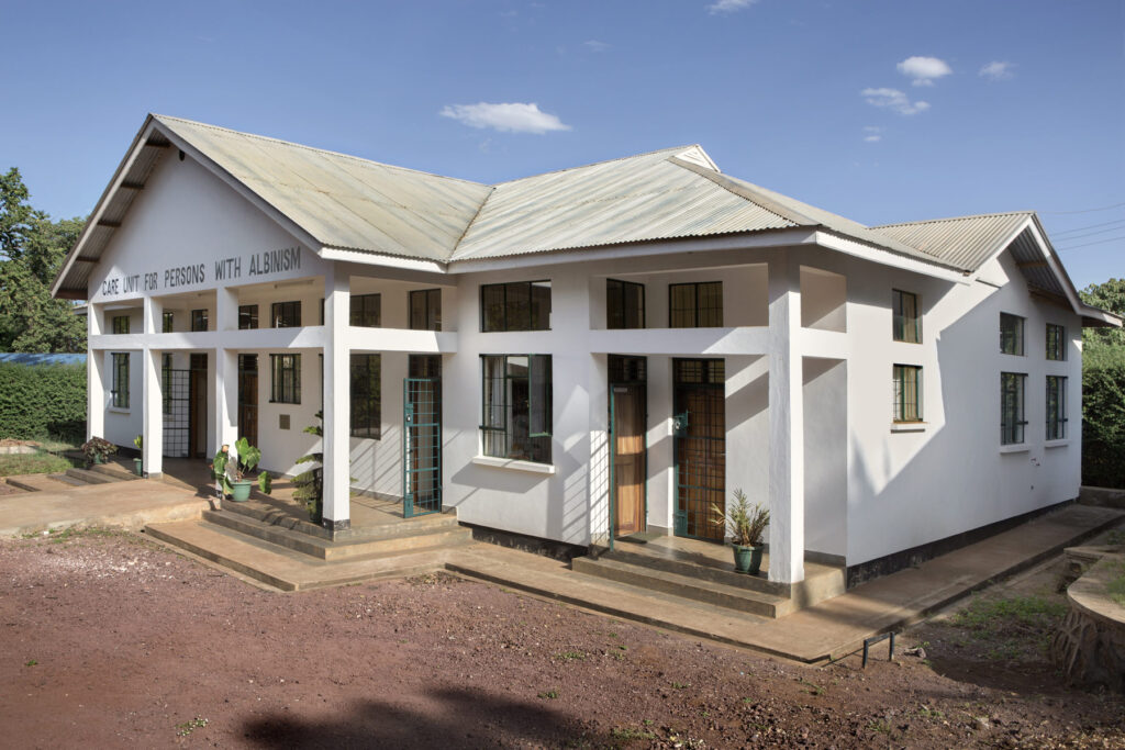 Albino - Project by Ana Palacios Visual Journalist