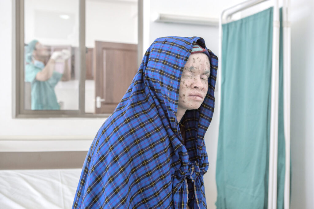 Albino - Project by Ana Palacios Visual Journalist