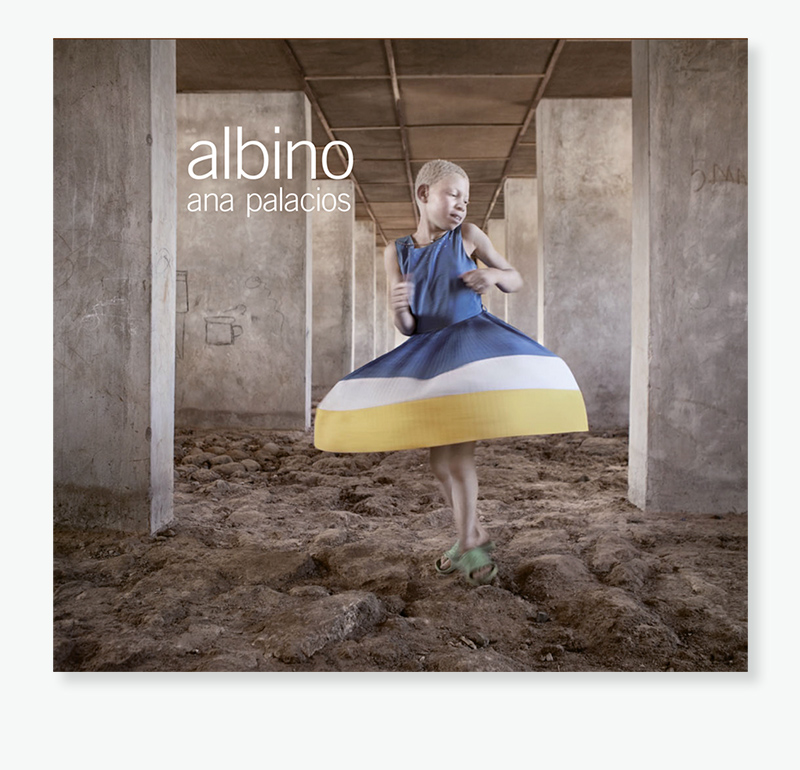Albino - Book by Ana Palacios Visual Journalist